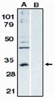 Bcl-10 Antibody in Western Blot (WB)