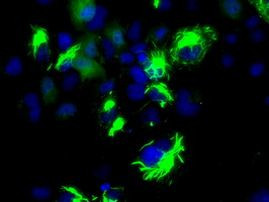 BCL10 Antibody in Immunocytochemistry (ICC/IF)