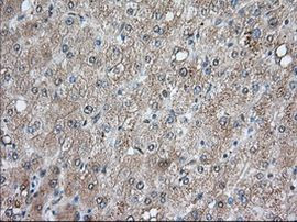 BCL10 Antibody in Immunohistochemistry (Paraffin) (IHC (P))