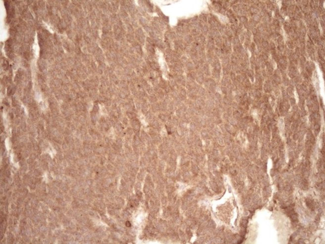 BCL2 Antibody in Immunohistochemistry (Paraffin) (IHC (P))