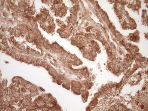 BCL2 Antibody in Immunohistochemistry (Paraffin) (IHC (P))