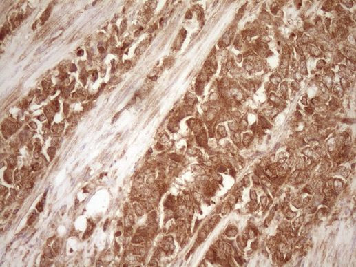 BCL2 Antibody in Immunohistochemistry (Paraffin) (IHC (P))