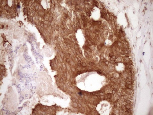 BCL2 Antibody in Immunohistochemistry (Paraffin) (IHC (P))