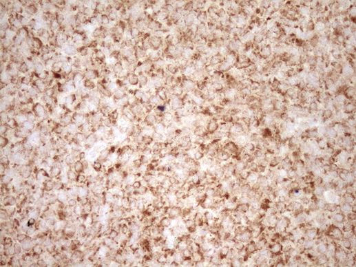 BCL2 Antibody in Immunohistochemistry (Paraffin) (IHC (P))