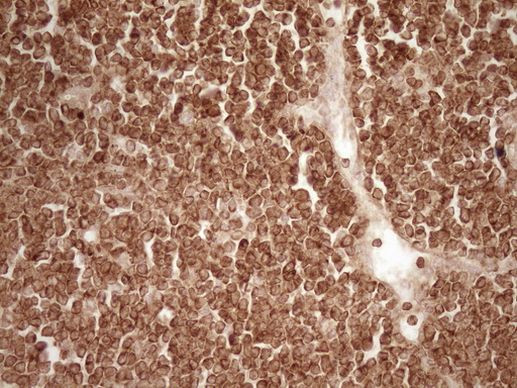 BCL2 Antibody in Immunohistochemistry (Paraffin) (IHC (P))