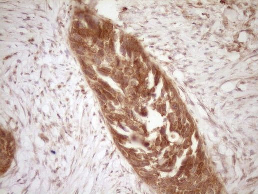 BCL2 Antibody in Immunohistochemistry (Paraffin) (IHC (P))