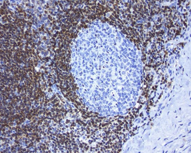 BCL2 Antibody in Immunohistochemistry (Paraffin) (IHC (P))