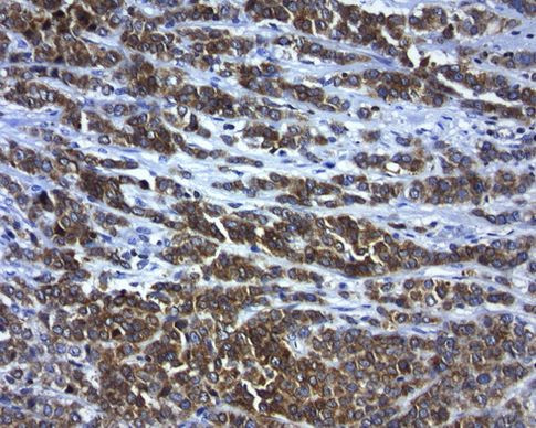 BCL2 Antibody in Immunohistochemistry (Paraffin) (IHC (P))