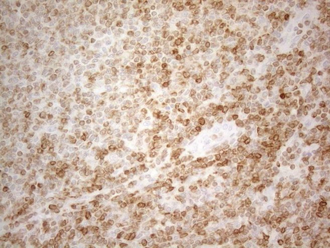 BCL2 Antibody in Immunohistochemistry (Paraffin) (IHC (P))