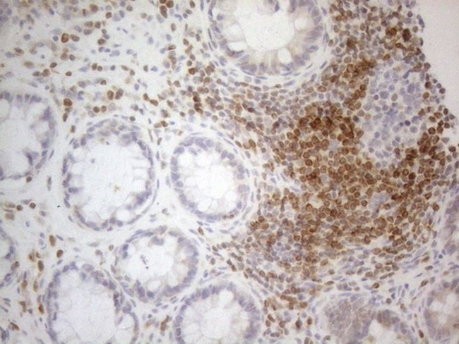 BCL2 Antibody in Immunohistochemistry (Paraffin) (IHC (P))