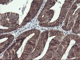 BCL2L1 Antibody in Immunohistochemistry (Paraffin) (IHC (P))