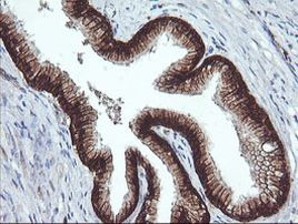 BCL2L1 Antibody in Immunohistochemistry (Paraffin) (IHC (P))