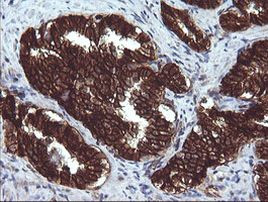 BCL2L1 Antibody in Immunohistochemistry (Paraffin) (IHC (P))