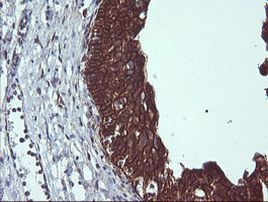 BCL2L1 Antibody in Immunohistochemistry (Paraffin) (IHC (P))