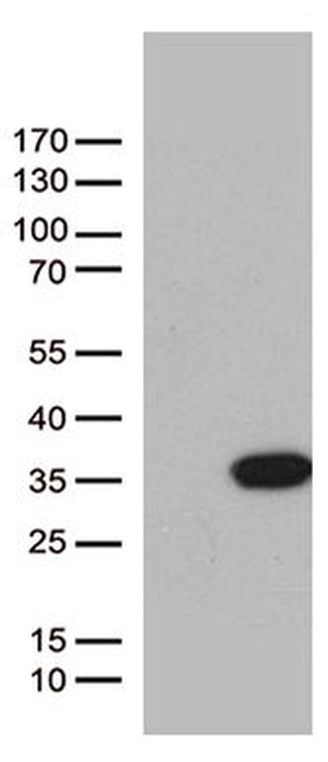 BCL2L11 Antibody in Western Blot (WB)
