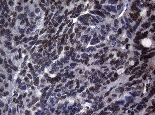 BCL6 Antibody in Immunohistochemistry (Paraffin) (IHC (P))