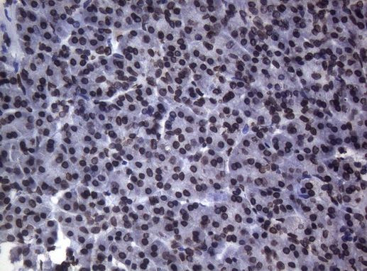 BCL6 Antibody in Immunohistochemistry (Paraffin) (IHC (P))