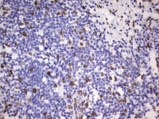 BCL6 Antibody in Immunohistochemistry (Paraffin) (IHC (P))