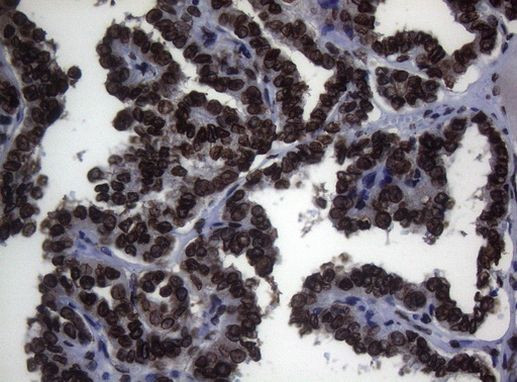 BCL6 Antibody in Immunohistochemistry (Paraffin) (IHC (P))