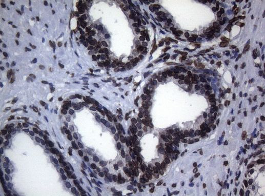 BCL6 Antibody in Immunohistochemistry (Paraffin) (IHC (P))