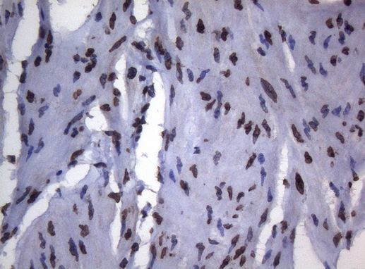 BCL6 Antibody in Immunohistochemistry (Paraffin) (IHC (P))