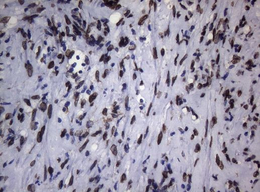 BCL6 Antibody in Immunohistochemistry (Paraffin) (IHC (P))