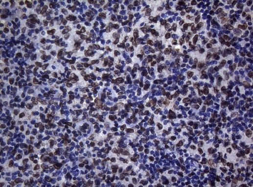 BCL6 Antibody in Immunohistochemistry (Paraffin) (IHC (P))