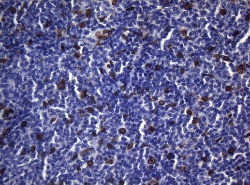 BCL6 Antibody in Immunohistochemistry (Paraffin) (IHC (P))