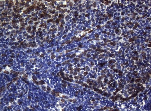 BCL6 Antibody in Immunohistochemistry (Paraffin) (IHC (P))