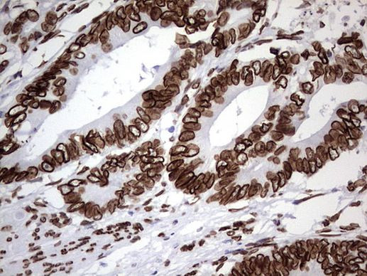 BCL6 Antibody in Immunohistochemistry (Paraffin) (IHC (P))