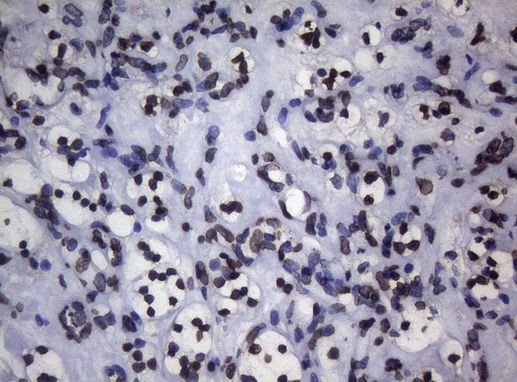 BCL6 Antibody in Immunohistochemistry (Paraffin) (IHC (P))