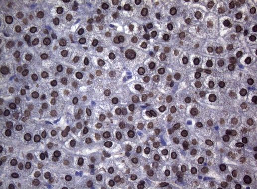 BCL6 Antibody in Immunohistochemistry (Paraffin) (IHC (P))