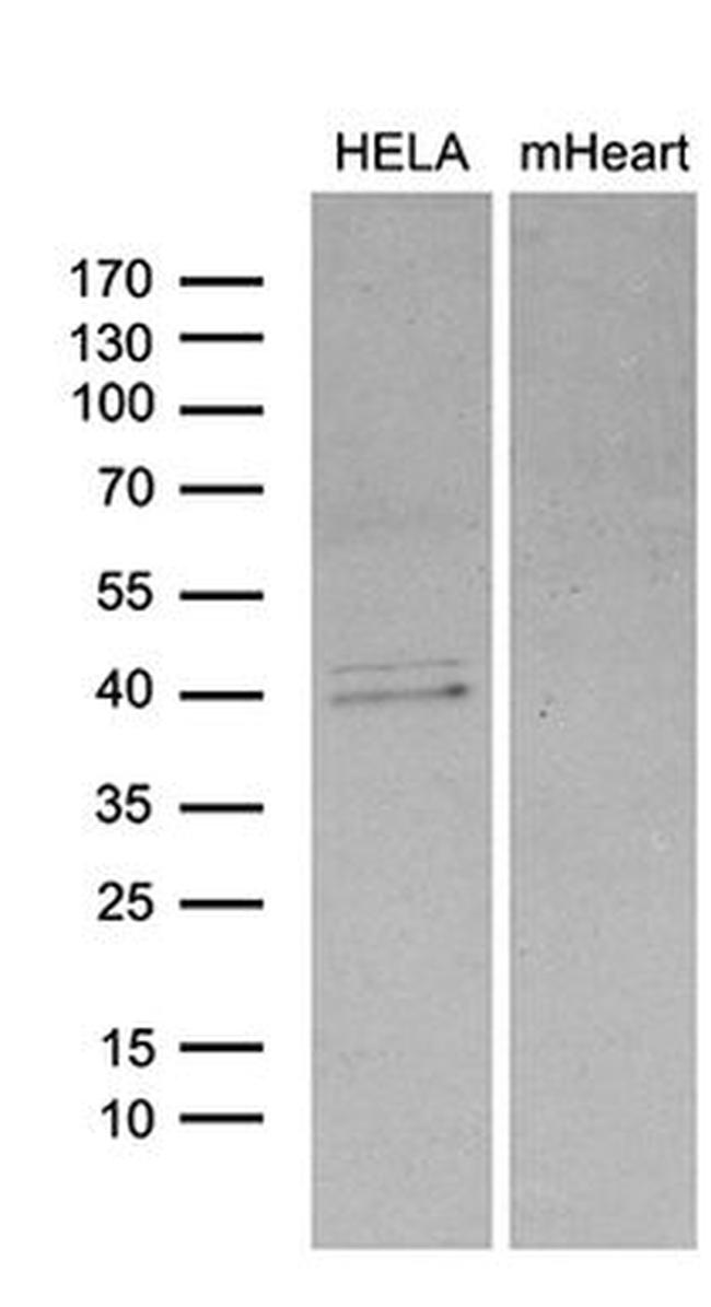 BCL7B Antibody in Western Blot (WB)