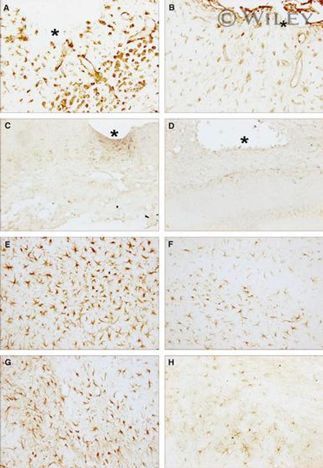 TNF alpha Antibody in Immunohistochemistry (Paraffin) (IHC (P))