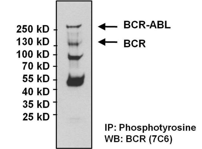 BCR-ABL Antibody in Western Blot (WB)