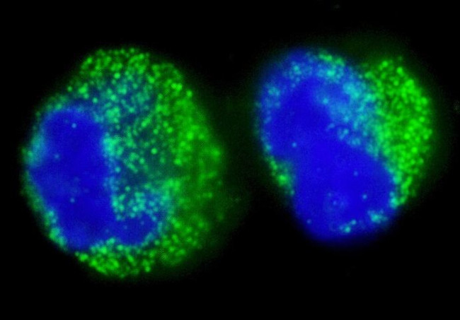 BCR Antibody in Immunocytochemistry (ICC/IF)