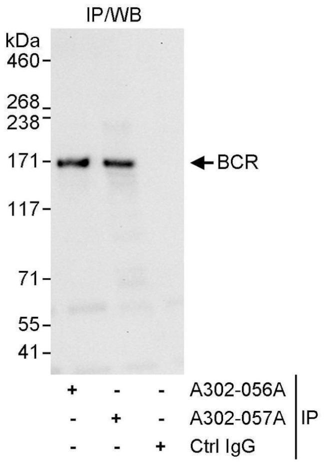 BCR Antibody in Immunoprecipitation (IP)