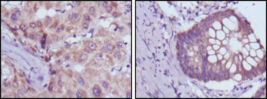 BDH1 Antibody in Immunohistochemistry (Paraffin) (IHC (P))