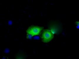 BDH2 Antibody in Immunocytochemistry (ICC/IF)