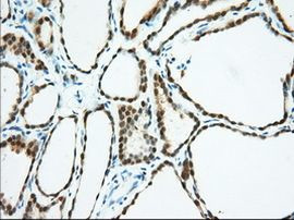 BDH2 Antibody in Immunohistochemistry (Paraffin) (IHC (P))