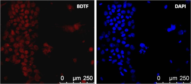 FALZ Antibody in Immunocytochemistry (ICC/IF)