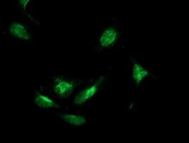 BECN1 Antibody in Immunocytochemistry (ICC/IF)