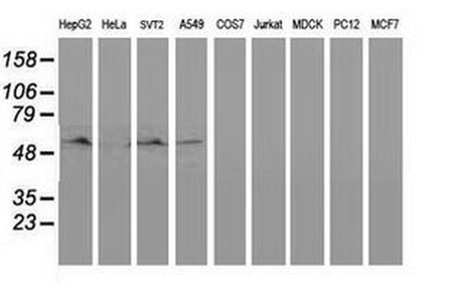 BECN1 Antibody in Western Blot (WB)