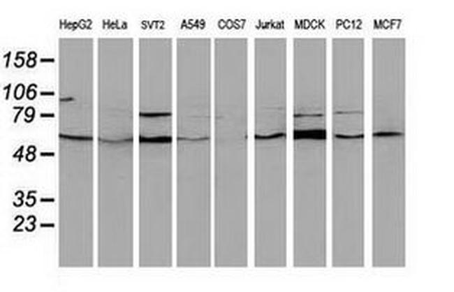 BECN1 Antibody in Western Blot (WB)