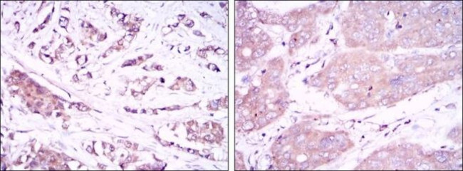 Beclin 1 Antibody in Immunohistochemistry (Paraffin) (IHC (P))