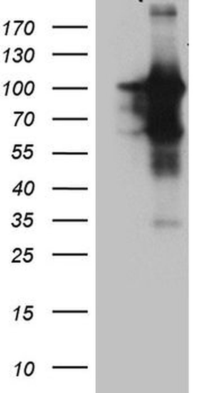 BEGAIN Antibody in Western Blot (WB)