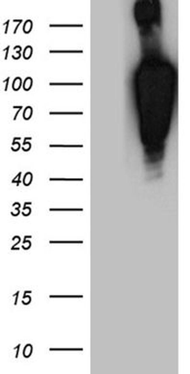 BEGAIN Antibody in Western Blot (WB)