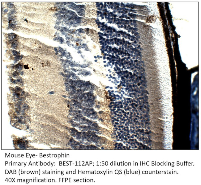 Bestrophin Antibody in Immunohistochemistry (IHC)