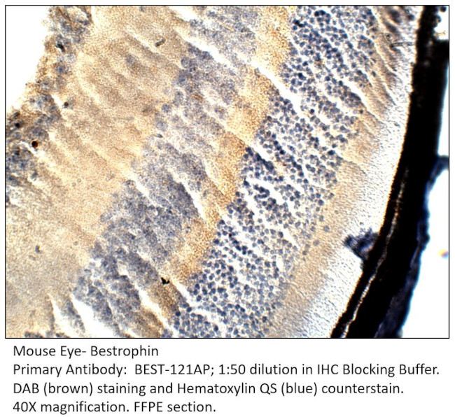 Bestrophin Antibody in Immunohistochemistry (IHC)