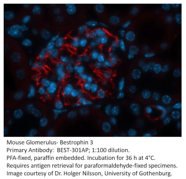 Bestrophin 3 Antibody in Immunohistochemistry (Paraffin) (IHC (P))